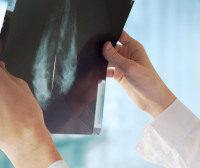Dense Breast Tissue: What Are the Risks and What Do I Do Next?